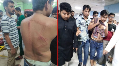 চাঁদাবাজির প্রতিবাদ করায় হামলার শিকার ঢাবি সাংবাদিক সমিতির সভাপতিসহ তিনজন